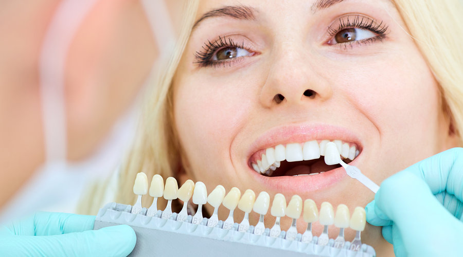 Estética dental